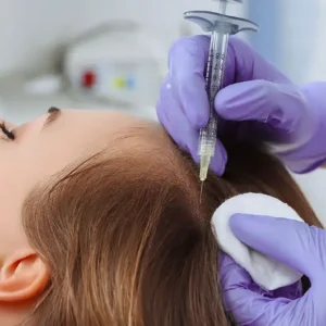 Diplomado en Tricología Estética y Microneedling Capilar